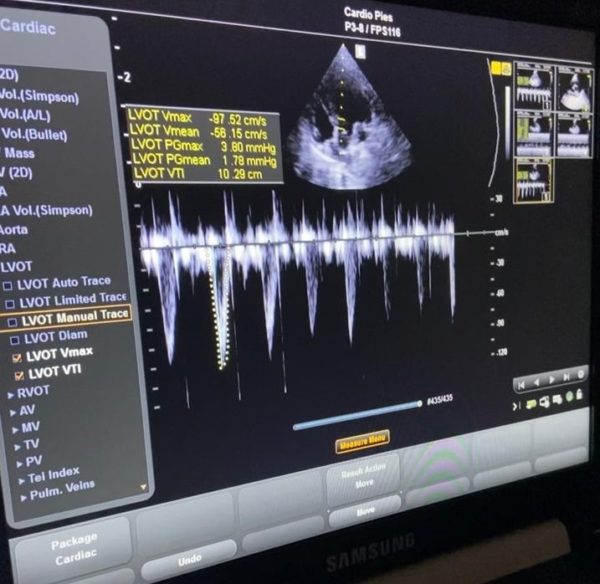ECHO SERCA Badanie echokardiograficzne psów i kotów